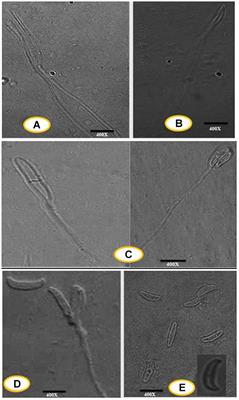 Pleiotropic Functions and Biological Potentials of Silver Nanoparticles Synthesized by an Endophytic Fungus